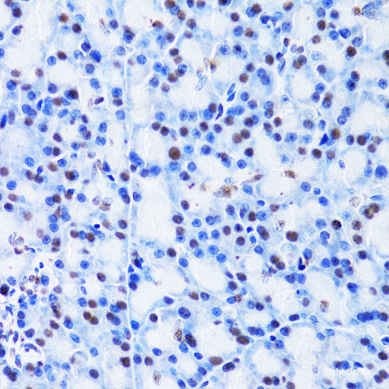 Immunofluorescence analysis of HeLa cells using CLEC3B Polyclonal Antibody