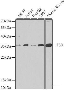 Immunohistochemistry of paraffin-embedded Human esophageal cancer using TUFM Polyclonal Antibody at dilution of 1:100 (40x lens).