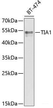 Immunofluorescence analysis of U2OS cells using C21orf33 Polyclonal Antibody