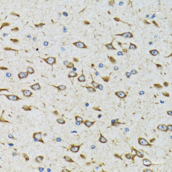 Immunofluorescence analysis of MCF7 cells using RNGTT Polyclonal Antibody