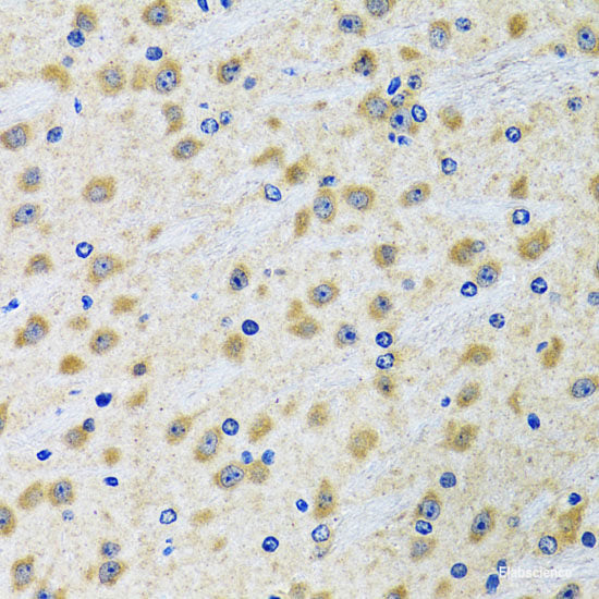 Immunohistochemistry of paraffin-embedded Mouse heart using MYOT Polyclonal Antibody at dilution of 1:100 (40x lens).