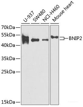 Immunofluorescence analysis of HeLa cells using SPAG5 Polyclonal Antibody