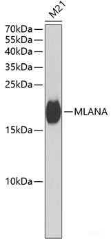 Western blot analysis of extracts of various cell lines using DDAH2 Polyclonal Antibody at dilution of 1:1000.