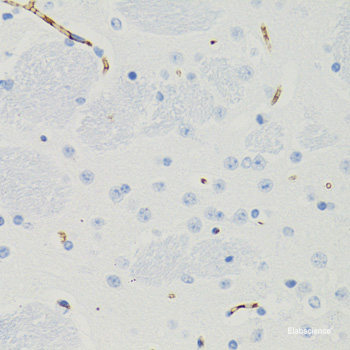 Western blot analysis of extracts of 293T cells using GNL3 Polyclonal Antibody at dilution of 1:1000.