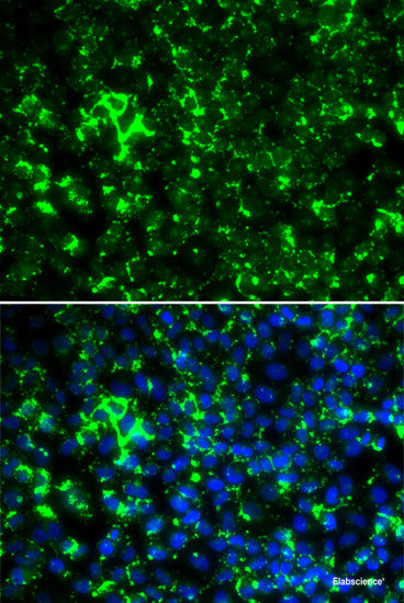 Immunofluorescence analysis of U2OS cells using TFPT Polyclonal Antibody
