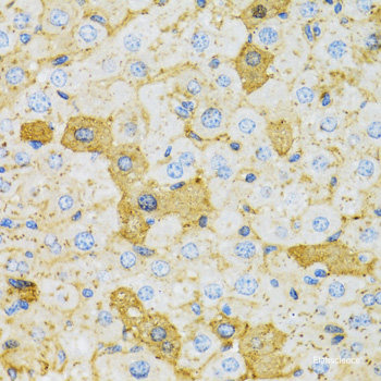 Immunofluorescence analysis of MCF-7 cells using RHOD Polyclonal Antibody