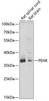 Immunohistochemistry of paraffin-embedded Rat brain using PTRH2 Polyclonal Antibody at dilution of 1:100 (40x lens).