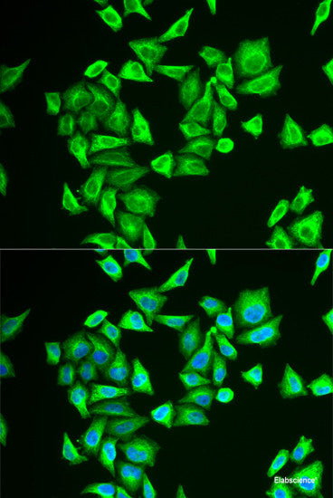 Western blot analysis of extracts of various cell lines using POLR3K Polyclonal Antibody at dilution of 1:1000.
