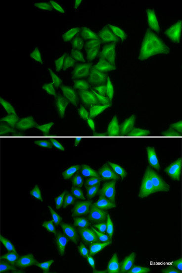 Immunofluorescence analysis of U2OS cells using MYOZ2 Polyclonal Antibody
