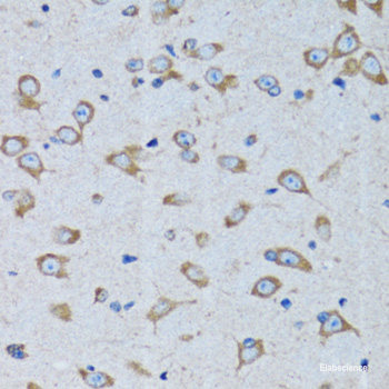 Immunohistochemistry of paraffin-embedded Human colon carcinoma using KRBOX4 Polyclonal Antibody at dilution of 1:200 (40x lens).