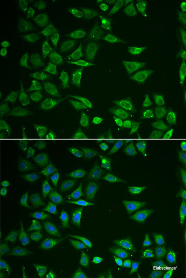 Immunohistochemistry of paraffin-embedded Rat heart using ACSS2 Polyclonal Antibody at dilution of 1:100 (40x lens).