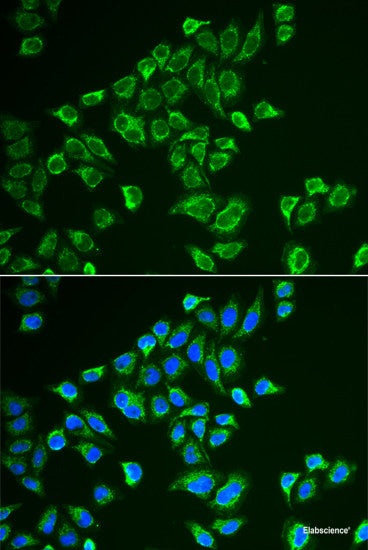 Immunofluorescence analysis of U2OS cells using TRPV5 Polyclonal Antibody