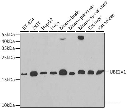 Immunohistochemistry of paraffin-embedded Rat kidney using CYP20A1 Polyclonal Antibody at dilution of 1:200 (40x lens).