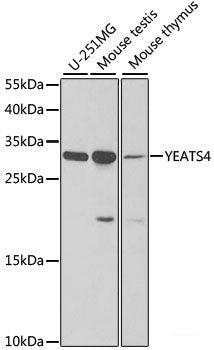 Immunofluorescence analysis of U2OS cells using NGB Polyclonal Antibody