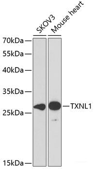 Immunofluorescence analysis of U2OS cells using LNX1 Polyclonal Antibody