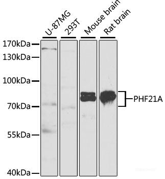 Immunohistochemistry of paraffin-embedded Mouse heart using UCN2 Polyclonal Antibody at dilution of 1:100 (40x lens).