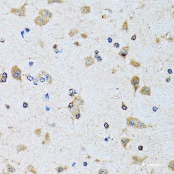 Immunofluorescence analysis of MCF7 cells using IL17F Polyclonal Antibody