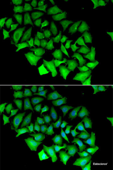 Immunohistochemistry of paraffin-embedded Rat kidney using HPD Polyclonal Antibody at dilution of 1:100 (40x lens).