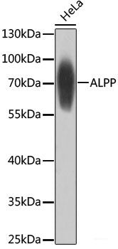 Western blot analysis of extracts of various cell lines using GLI2 Polyclonal Antibody at dilution of 1:1000.