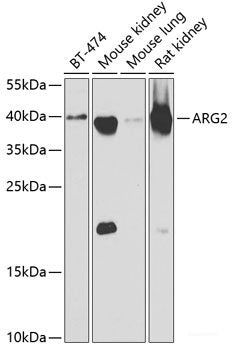 Immunofluorescence analysis of MCF7 cells using ADSS Polyclonal Antibody