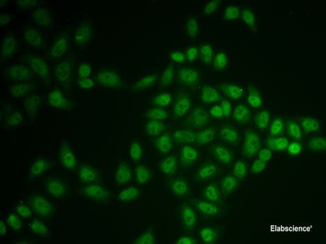 Immunohistochemistry of paraffin-embedded Mouse brain using AKAP5 Polyclonal Antibody at dilution of 1:100 (40x lens).