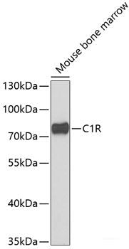 Immunofluorescence analysis of HeLa cells using ALAS2 Polyclonal Antibody