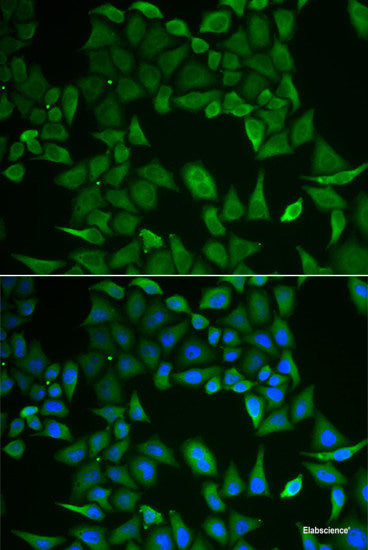 Immunofluorescence analysis of A549 cells using ANLN Polyclonal Antibody