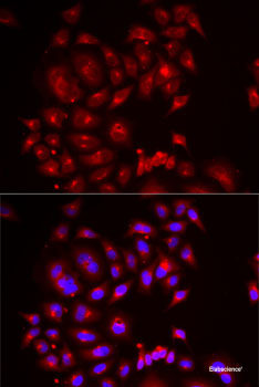 Western blot analysis of extracts of various cell lines using ANTXR2 Polyclonal Antibody at dilution of 1:1000.