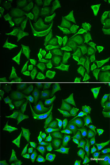 Immunofluorescence analysis of HeLa cells using ASF1A Polyclonal Antibody