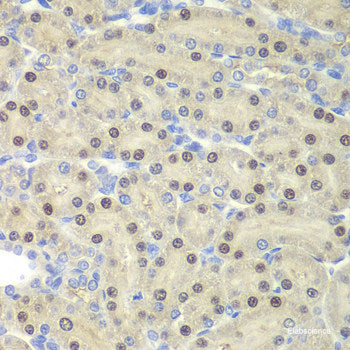 Immunofluorescence analysis of MCF7 cells using ASMT Polyclonal Antibody