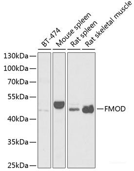 Immunofluorescence analysis of HeLa cells using ATP6AP2 Polyclonal Antibody