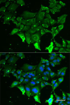 Immunohistochemistry of paraffin-embedded Mouse lung using BHLHE40 Polyclonal Antibody at dilution of 1:100 (40x lens).