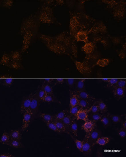 Immunofluorescence analysis of HeLa cells using BLMH Polyclonal Antibody