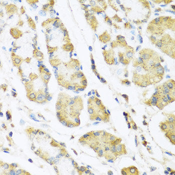 Immunohistochemistry of paraffin-embedded Mouse liver using CCBL1 Polyclonal Antibody at dilution of 1:100 (40x lens).