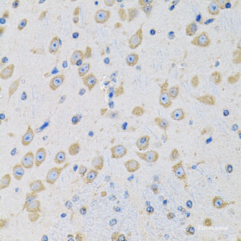 Immunohistochemistry of paraffin-embedded Human liver using CCM2 Polyclonal Antibody at dilution of 1:100 (40x lens).