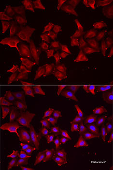 Immunofluorescence analysis of HeLa cells using CCT2 Polyclonal Antibody