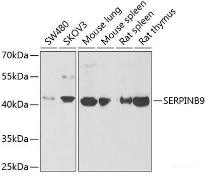 Immunohistochemistry of paraffin-embedded Mouse heart using CCT3 Polyclonal Antibody at dilution of 1:100 (40x lens).