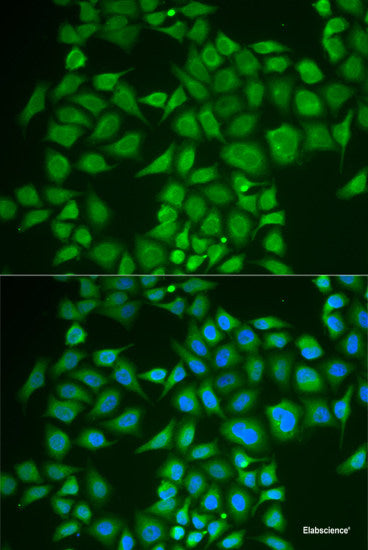 Western blot analysis of extracts of BT-474 cells using CD177 Polyclonal Antibody at dilution of 1:1000.