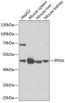 Immunofluorescence analysis of HeLa cells using CDKN2D Polyclonal Antibody
