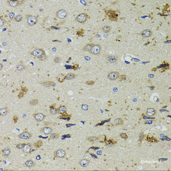 Immunohistochemistry of paraffin-embedded Human oophoroma using CENPC Polyclonal Antibody at dilution of 1:200 (40x lens).