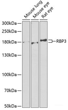 Immunofluorescence analysis of HeLa cells using CLDN2 Polyclonal Antibody