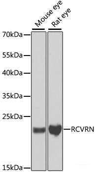 Western blot analysis of extracts of various cell lines using CMPK1 Polyclonal Antibody at dilution of 1:1000.