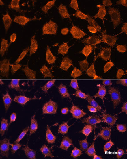 Western blot analysis of extracts of HeLa cells using CPM Polyclonal Antibody at dilution of 1:1000.