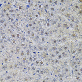 Immunohistochemistry of paraffin-embedded Rat heart using CRHBP Polyclonal Antibody at dilution of 1:100 (40x lens).