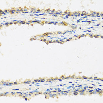 Immunohistochemistry of paraffin-embedded Rat brain using CSRP3 Polyclonal Antibody at dilution of 1:100 (40x lens).