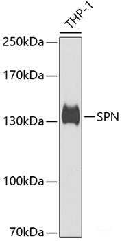 Immunohistochemistry of paraffin-embedded Rat brain using CST1 Polyclonal Antibody at dilution of 1:100 (40x lens).