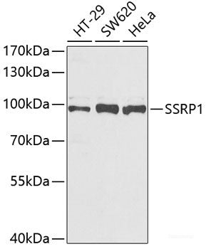 Western blot analysis of extracts of Mouse heart using CST2 Polyclonal Antibody at dilution of 1:1000.