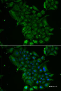 Immunofluorescence analysis of U2OS cells using CTNNBL1 Polyclonal Antibody