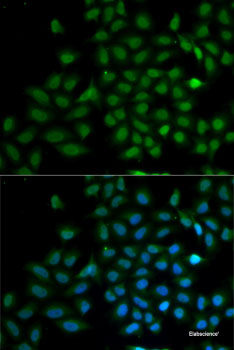Western blot analysis of extracts of various cell lines using DARS Polyclonal Antibody at dilution of 1:1000.