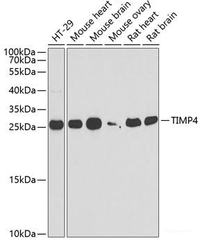 Western blot analysis of extracts of various cell lines using DDX1 Polyclonal Antibody at dilution of 1:1000.